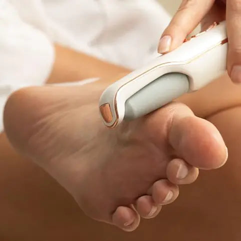 Electric Foot File Hard Skin Remover for Calluses